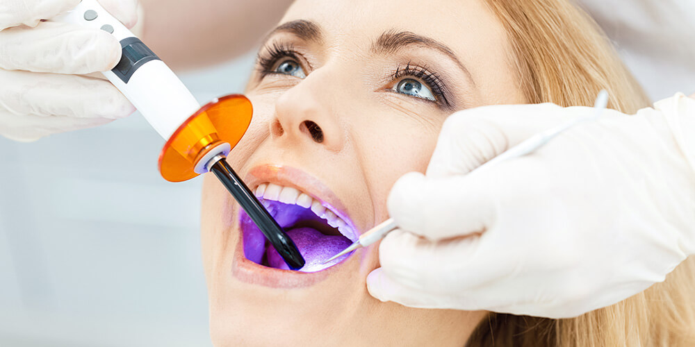 Dental Bonding Oakville